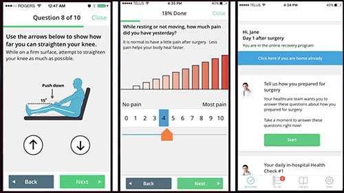 Mobile app helps rural patients with pre and post-op care