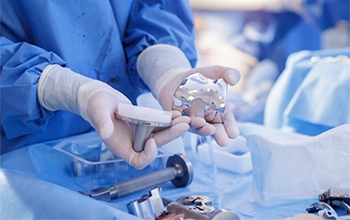 How Long Do Joint Implants Last? What Patients Should Expect