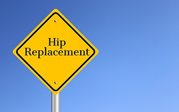 What Are Signs of Needing a Hip Replacement?