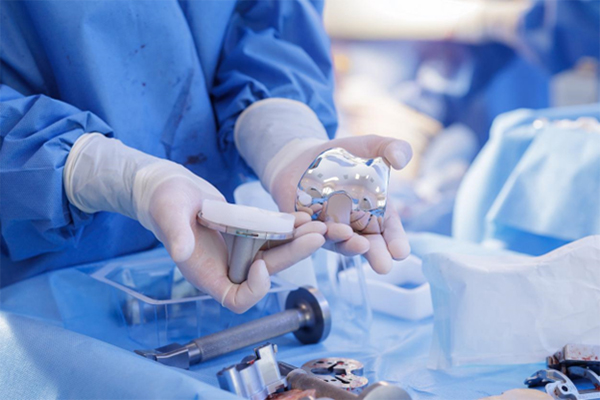 How Long Do Joint Implants Last? What Patients Should Expect