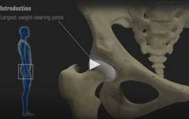 Minimally Invasive Total Hip Replacement