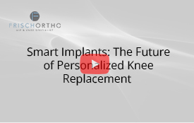 Smart Implants: The Future of Personalized Knee Replacement